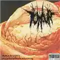 Tumour Anatropic Nephrolithotomy