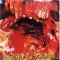 Paracoccidioidomicosisproctitissarcomucosis Satyriasis And Nymphomania