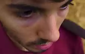 Fulminacci