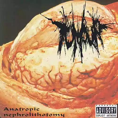 Cover di Anatropic Nephrolithotomy