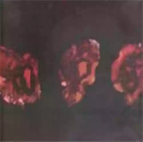 Cover di Kénôse