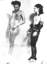 Image ofPremature Ejaculation