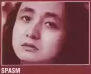 Image ofSpasm