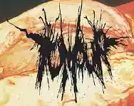 Immagine di Tumour