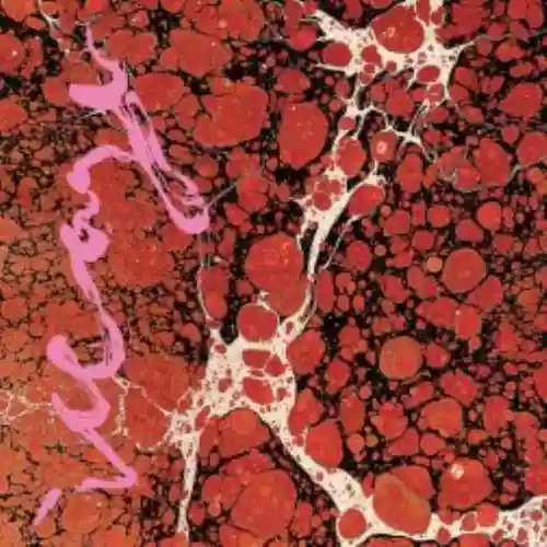 Cover Iceage - Beyondless